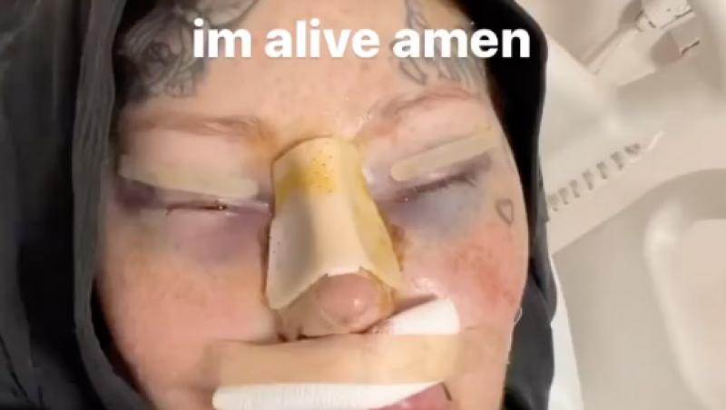 Reacția internauților când au aflat cum arăta tânăra înainte de operații și tatuaje. Transformările au început când avea 21 de ani