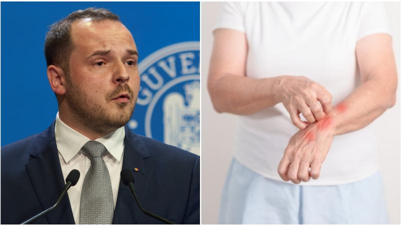 Ministrul Sănătății, Alexandru Rogobete