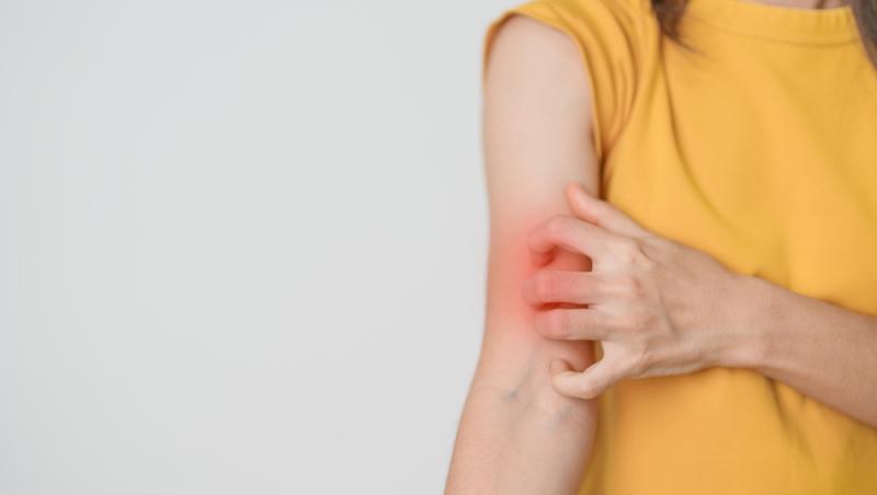 S-a confirmat primul caz de lepră în România după 44 de ani! Încă 3 suspiciuni se aplică în cazul unor maseuze asiatice din Cluj