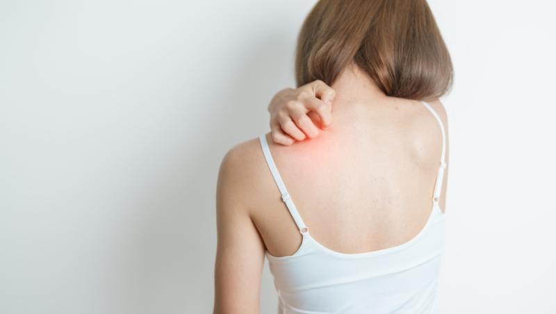 S-a confirmat primul caz de lepră în România după 44 de ani! Încă 3 suspiciuni se aplică în cazul unor maseuze asiatice din Cluj