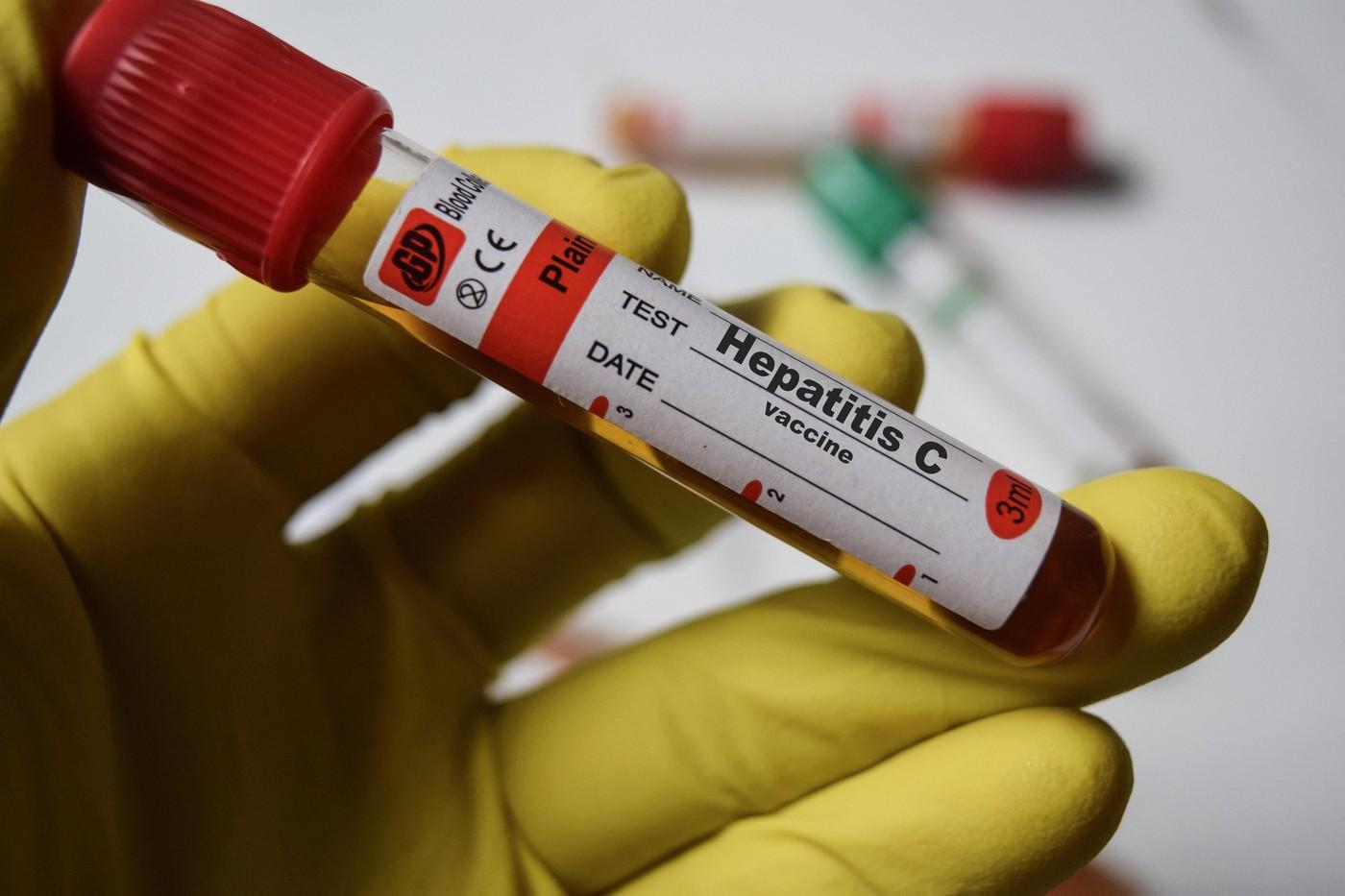 Românii se pot testa gratuit pentru hepatită B, hepatită C și HIV. Care sunt condițiile și ce informații trebuie să afli