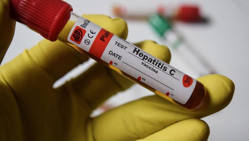 imagine cu o eprubeta de sange