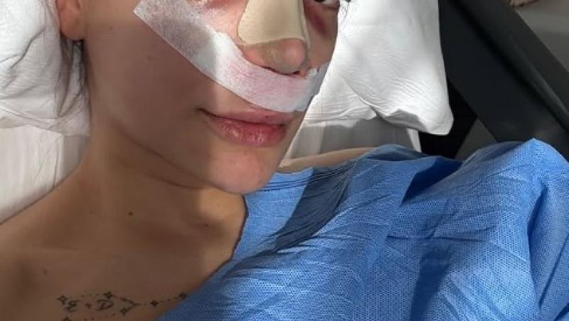 Cum arată acum Daiana Prodan, concurenta de la Insula Iubirii sezonul 8, la 15 zile după rinoplastie. S-a fotografiat fără bandaje