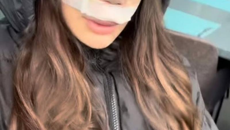 Daiana Prodan, concurenta de la Insula Iubirii sezonul 8, a apelat la ajutorul medicului plastician. Despre ce schimbare e vorba