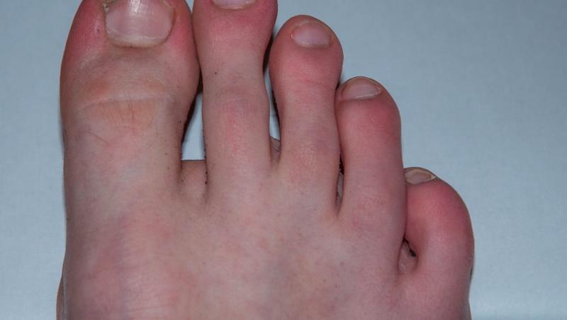 imagine cu un picior