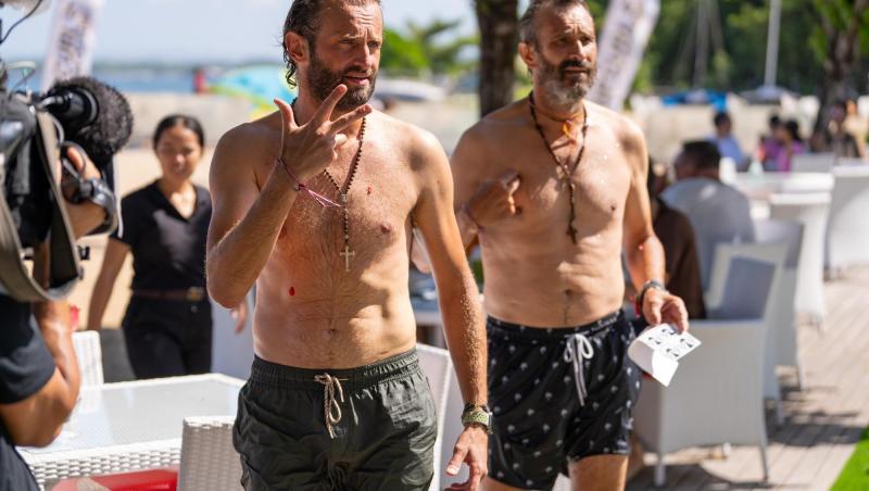 Sorin Brotnei a suferit o intervenție estetică. De ce nu mai vrea să iasă din casă