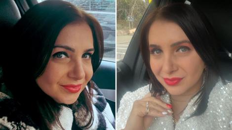 Carmen Șerban, complicații &icirc;n urma unui lifting facial: &bdquo;Sunt &icirc;n recuperare&rdquo;. Cum se simte artista acum