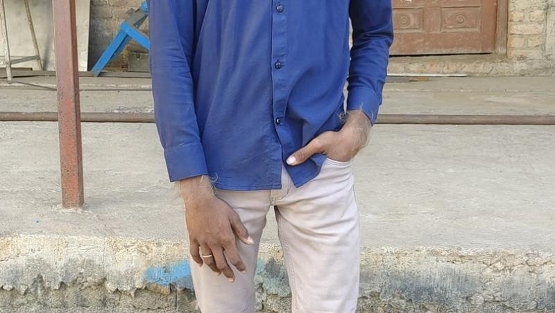 Tânărul care a intrat în Cartea Recordurilor pentru „cea mai păroasă față din lume”. De ce afecțiune rară suferă