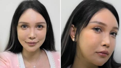 Femeia care a făcut peste o sută de operații estetice. Cum arăta înainte | VIDEO