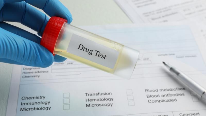Un polițist și-a făcut un drugtest de 1 aprilie şi a ieşit pozitiv. Acum este cercetat. Ce au arătat analizele de sânge