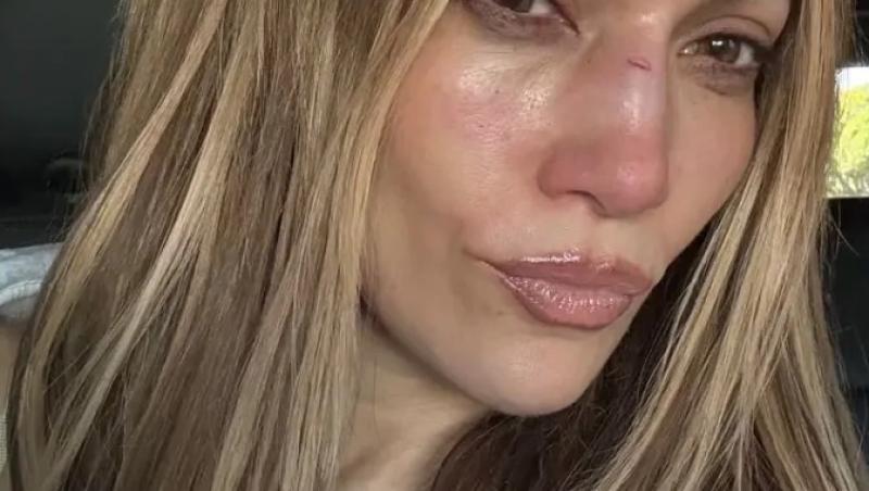 Jennifer Lopez arătându-le fanilor nasul ei