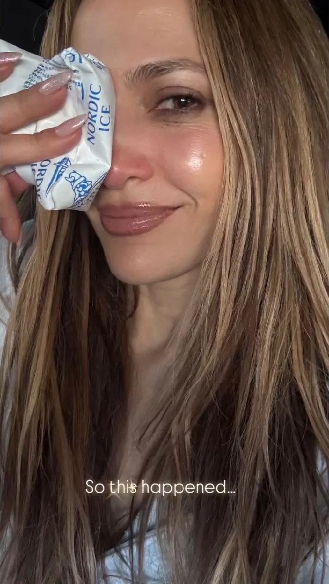 Jennifer Lopez ținând un pachet cu gheață la ochiul drept