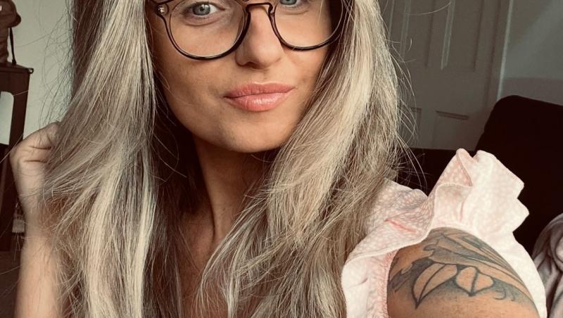 Tânăra a luat un tratament puternic și s-a trezit cu o peliculă verde pe față. Ce i s-a întâmplat și cum arăta înainte