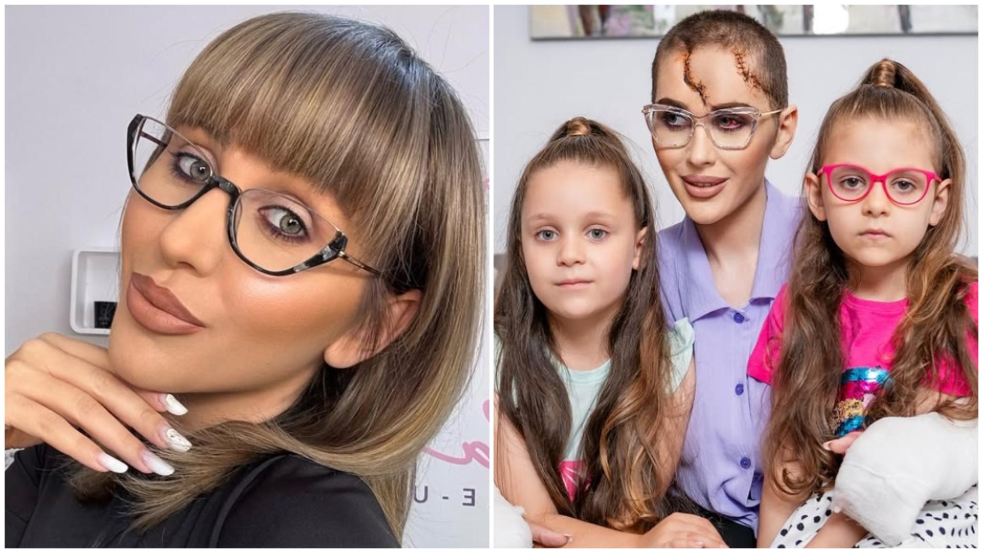 Dana Roba, nevoită să se opereze din nou la cap! Drama continuă la aproape 2 ani de la tragicul eveniment. Ce i-au spus medicii