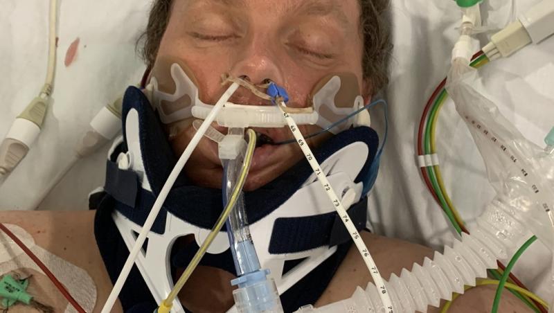 El e bărbatul care a fost decapitat într-un accident,dar încă trăiește. A fost supranumit „bărbatul cu cele mai multe oase rupte”