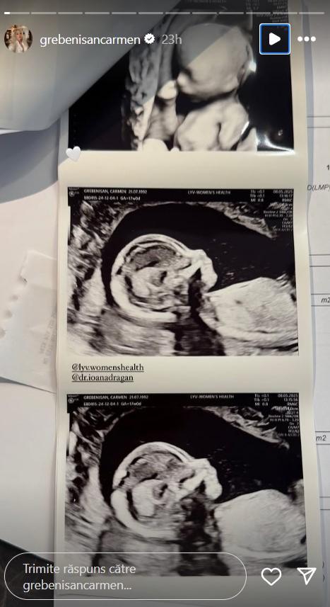 Carmen Grebenișan, primele imagini cu bebelușul. Influencerița și iubitul ei, Cristi, urmează să devină părinți pentru prima dată