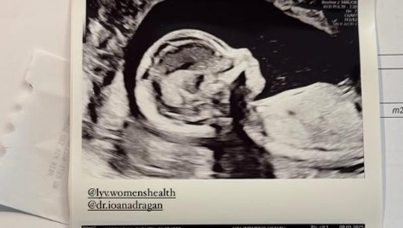 Carmen Grebenișan, primele imagini cu bebelușul. Influencerița și iubitul ei, Cristi, urmează să devină părinți pentru prima dată