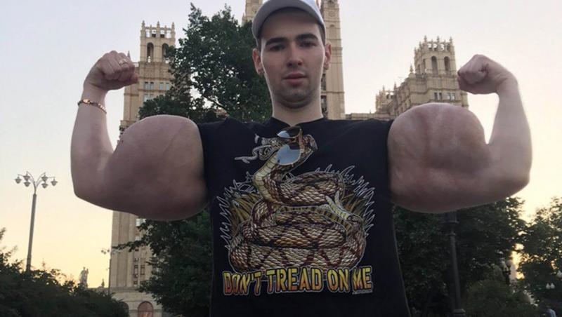 „Popeye”, tânărul care și-a injectat ulei în brațe ca să impresioneze pe internet, a ajuns la spital: „Cum vei câștiga bani acum?”