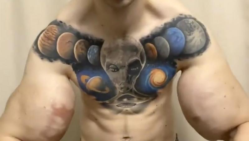 „Popeye”, tânărul care și-a injectat ulei în brațe ca să impresioneze pe internet, a ajuns la spital: „Cum vei câștiga bani acum?”