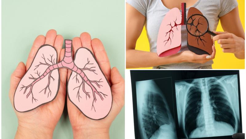 colaj foto cu o radiografie si mainile unei persoane care tin un mulaj cu plamani