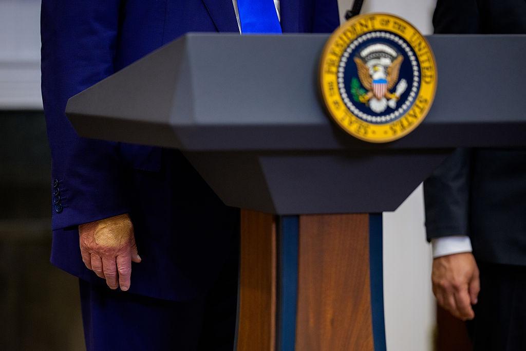 O imagine cu mâinile lui Donald Trump