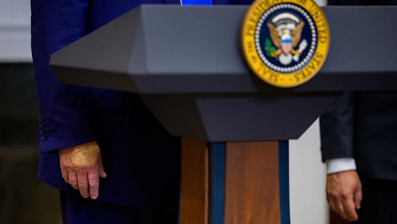 O imagine cu mâinile lui Donald Trump