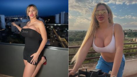 Cum arată femeia care are acum cele mai mari buze din lume. Cât a plătit pentru intervenții