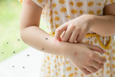 Ghidul complet al înțepăturilor de insecte. Cum să recunoști semnele lăsate de căpușe, ploșnițe, albine sau păianjeni