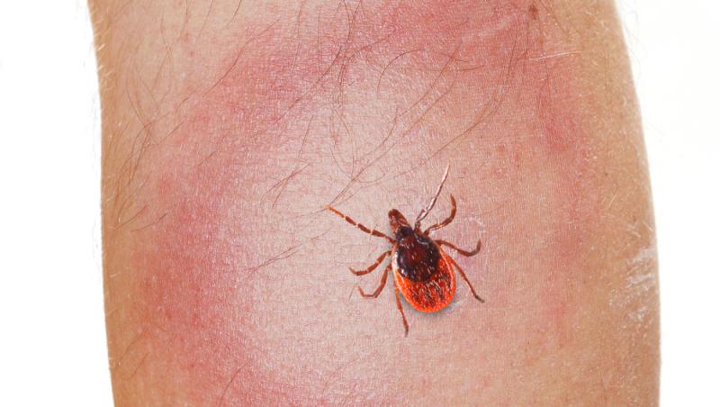 Unul dintre simptomele bolii Lyme transmise de căpușe este un cerc ca o țintă în jurul înțepăturii, cu centrul mai deschis la culoare și contur roșu