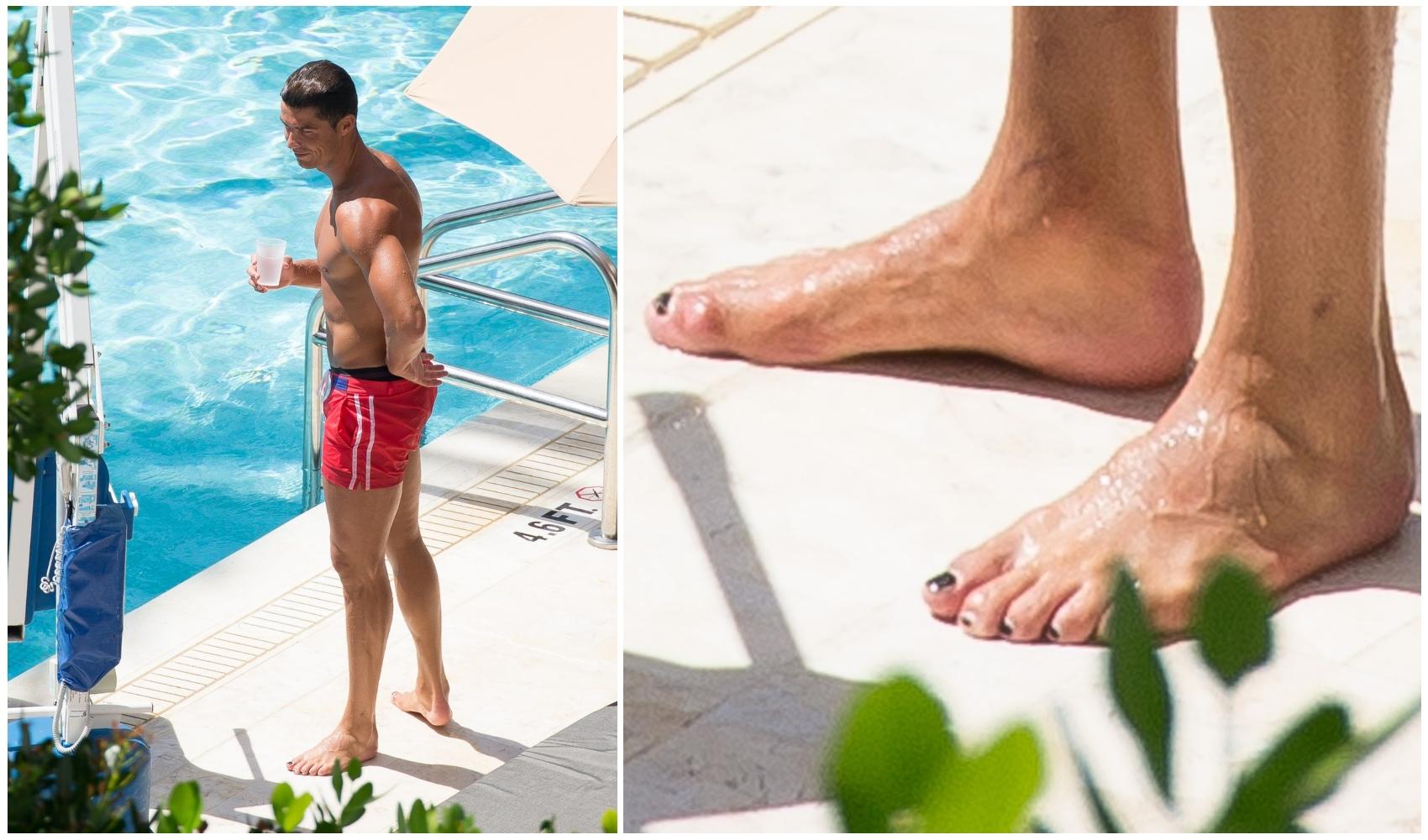 imagine cu cristiano ronaldo si unghiile lui negre de la picioare