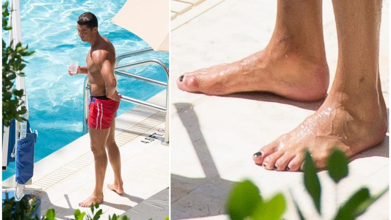 imagine cu cristiano ronaldo si unghiile lui negre de la picioare