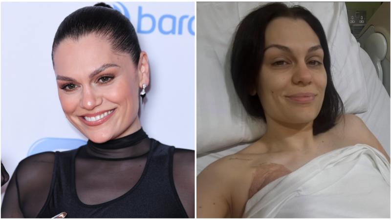 colaj Jessie J