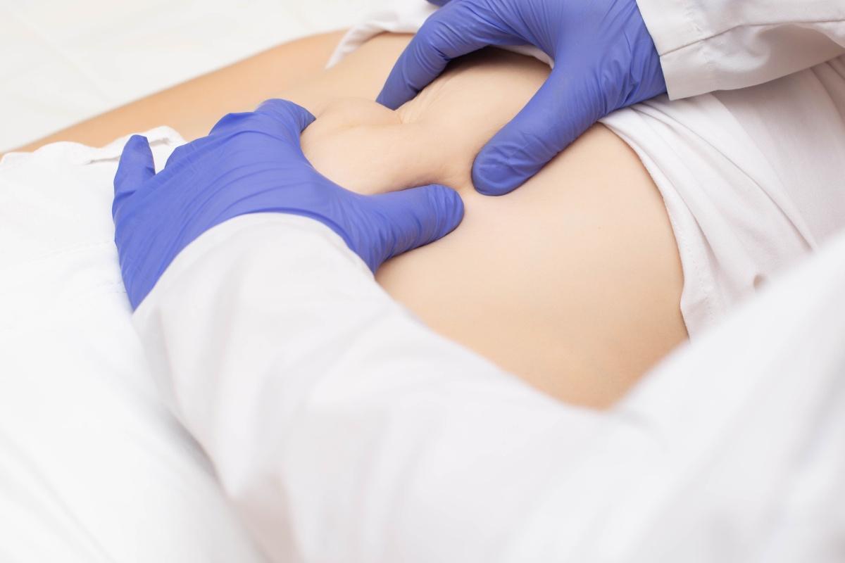 (P) Simptomele herniei hiatale: cum să recunoști semnele acestei afecțiuni?