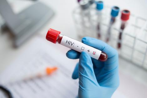 Descoperire inedită în tratarea HIV. Experții au fost „copleșiți” când au realizat acest lucru