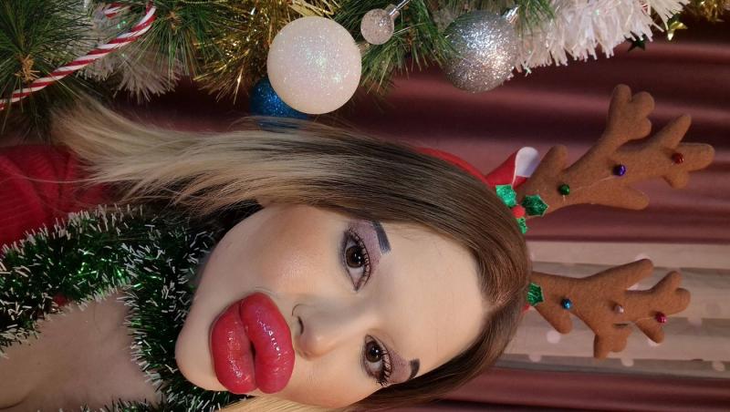 Femeia cu cele mai mari buze din lume a fost refuzată de stomatologi. De ce nu au vrut specialiștii să o trateze