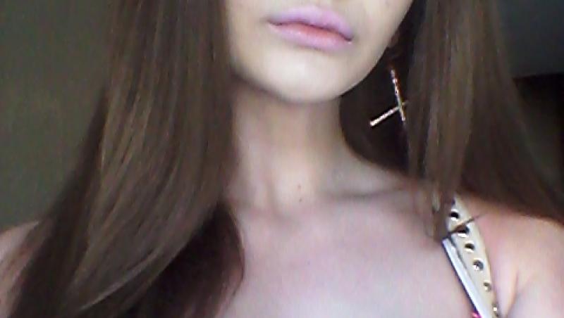 Femeia cu cele mai mari buze din lume a fost refuzată de stomatologi. De ce nu au vrut specialiștii să o trateze