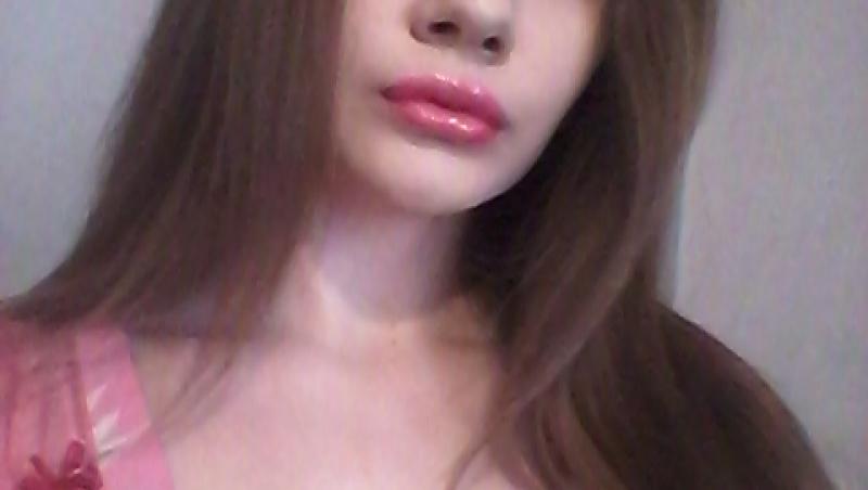 Femeia cu cele mai mari buze din lume a fost refuzată de stomatologi. De ce nu au vrut specialiștii să o trateze