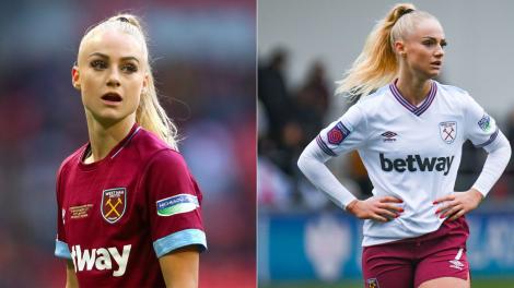 Cum arată acum cea mai frumoasă fotbalistă din lume, după ce a apelat la ajutorul medicului estetician. Sportiva, de nerescunocut