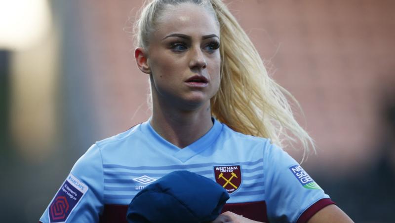 Cum arată acum cea mai frumoasă fotbalistă din lume, după ce a apelat la ajutorul medicului estetician. Sportiva, de nerescunocut