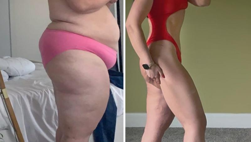 O tânără a slăbit 63 de kilograme, dar nu e fericită și spune că îi e dor de obezitate. De ce crede că viața ei era mai ușoară