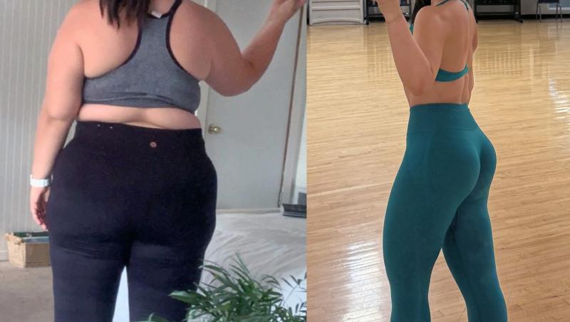 O tânără a slăbit 63 de kilograme, dar nu e fericită și spune că îi e dor de obezitate. De ce crede că viața ei era mai ușoară