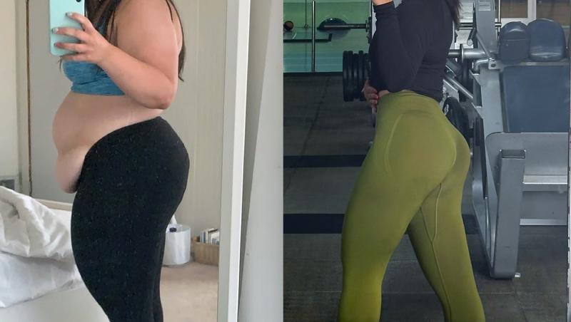O tânără a slăbit 63 de kilograme, dar nu e fericită și spune că îi e dor de obezitate. De ce crede că viața ei era mai ușoară