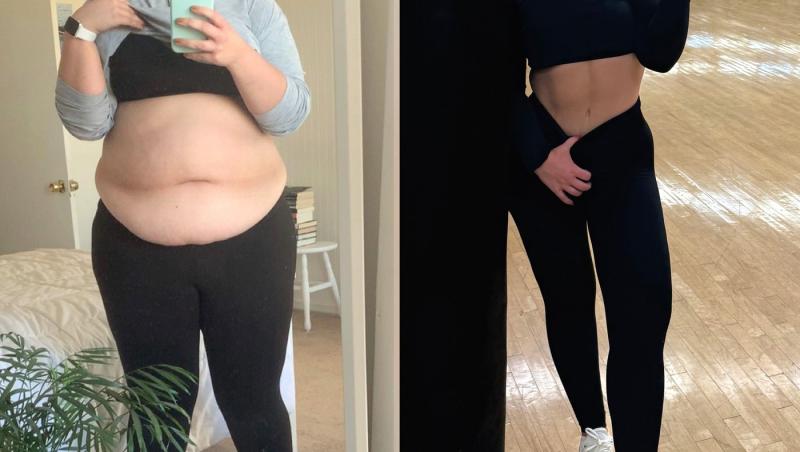 O tânără a slăbit 63 de kilograme, dar nu e fericită și spune că îi e dor de obezitate. De ce crede că viața ei era mai ușoară