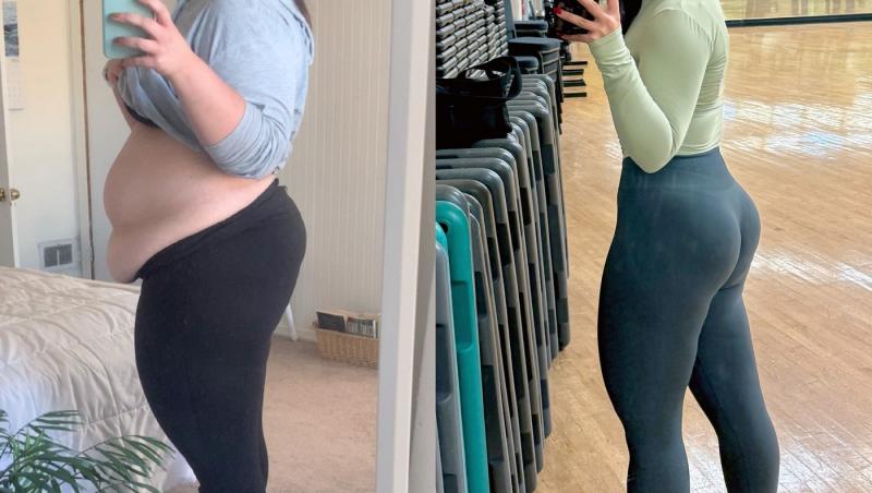 O tânără a slăbit 63 de kilograme, dar nu e fericită și spune că îi e dor de obezitate. De ce crede că viața ei era mai ușoară