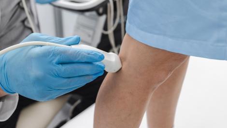 (P) Circulația deficitară: Cum o depistezi cu ajutorul ecografiei Doppler