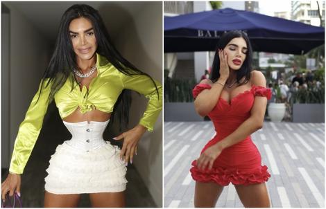O tânără din Miami, pusă la zid după ce a recunoscut că poartă corset 23 de ore pe zi: „Ridicolă”. Cum arată