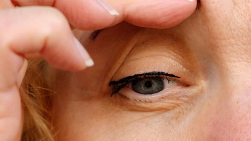 Benzile adezive pentru ochi s-au transformat dintr-un truc rapid în coșmar. Ce au pățit femeile care le-au folosit