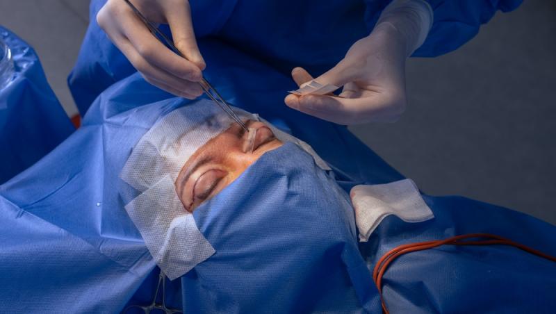 Benzile adezive pentru ochi s-au transformat dintr-un truc rapid în coșmar. Ce au pățit femeile care le-au folosit