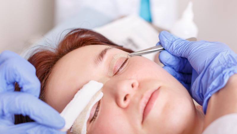 Benzile adezive pentru ochi s-au transformat dintr-un truc rapid în coșmar. Ce au pățit femeile care le-au folosit