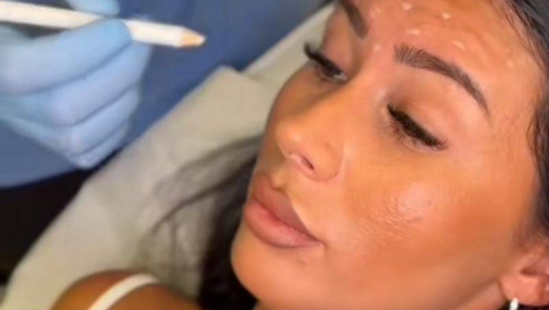 Bianca Dan de la Insula Iubirii și-a făcut o nouă intervenție estetică. De ce a apelat la medicul estetician
